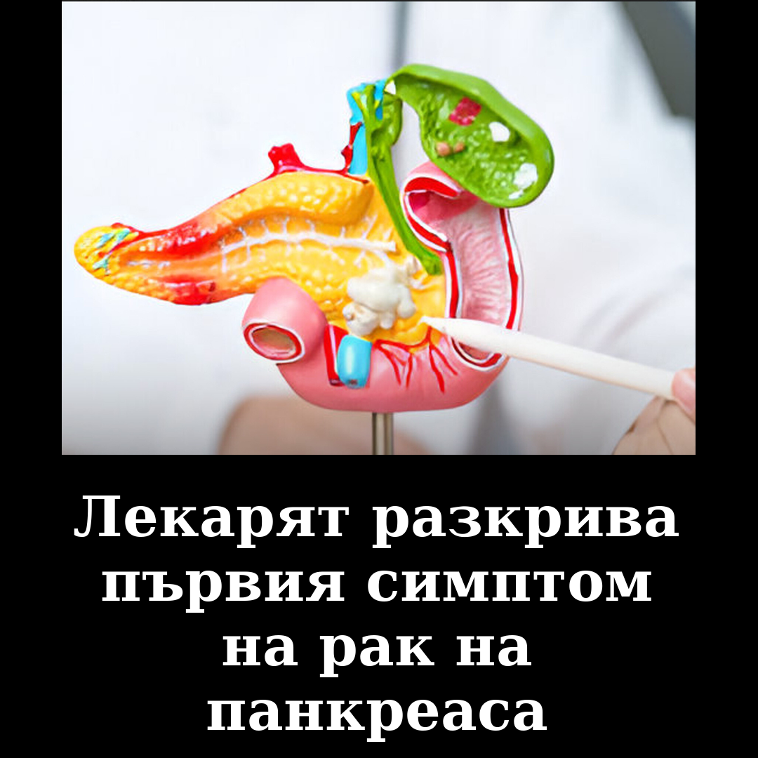 Popup Image