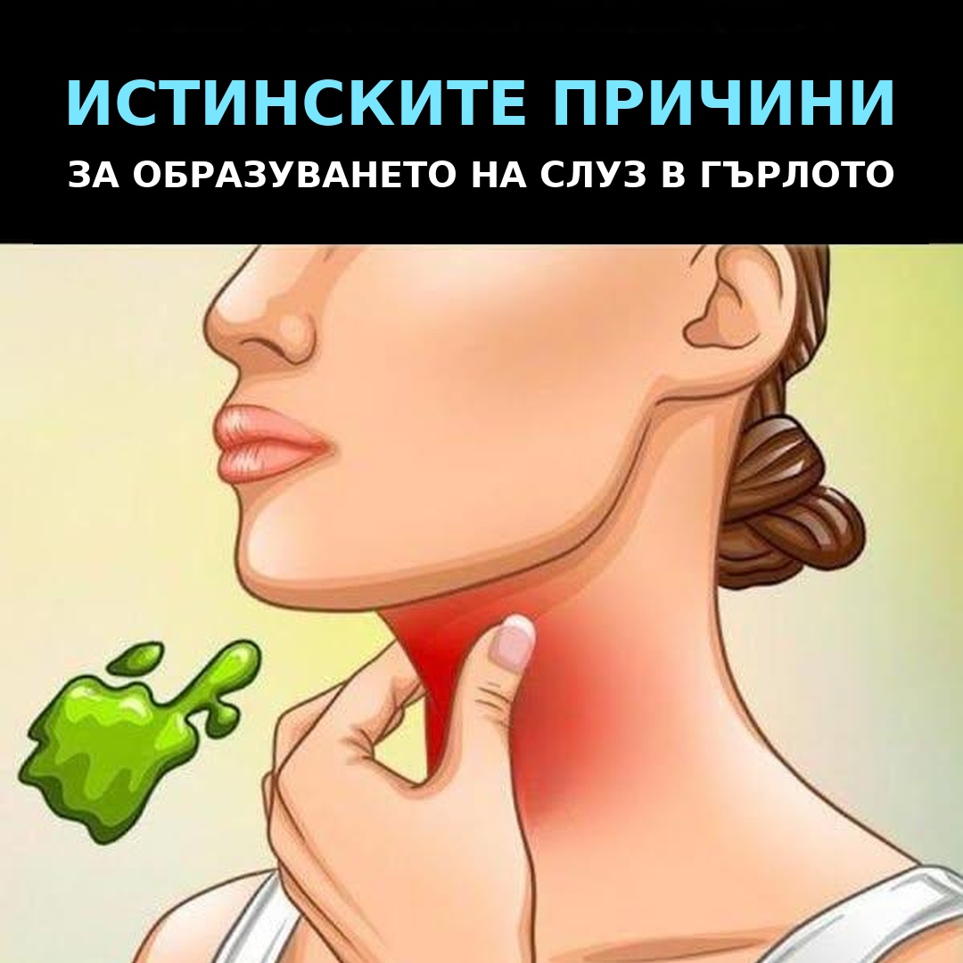 Popup Image