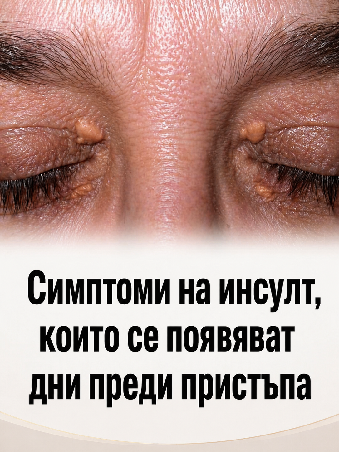 Popup Image